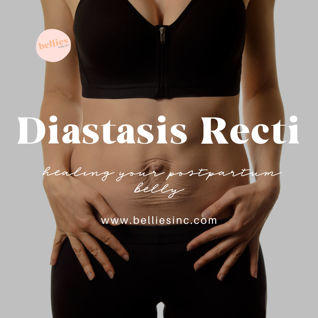 Diastasis Recti: Healing Your Postpartum Belly – bellies inc.